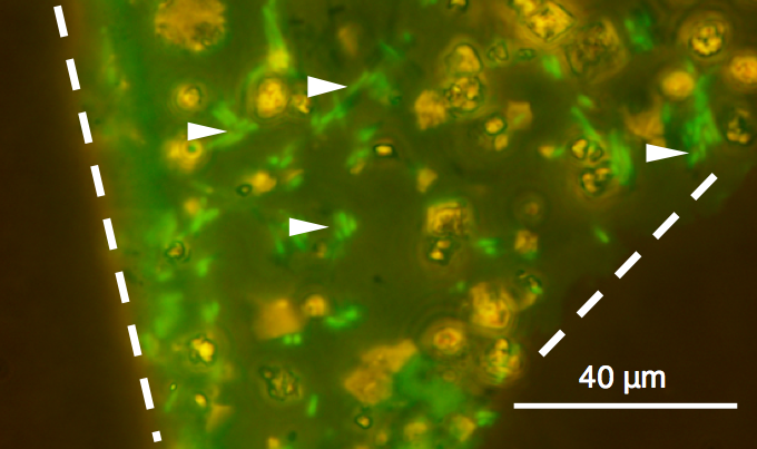 プロジェクト：火星からのサンプルリターンで有効な微生物不活化技術の開発に成功